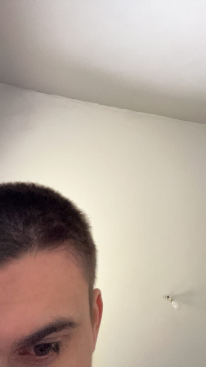 Profil de Solomon